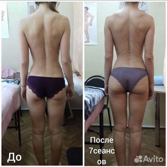 Массаж - 2 см с талии, модели