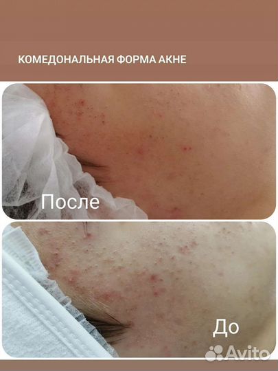 Услуги косметолога
