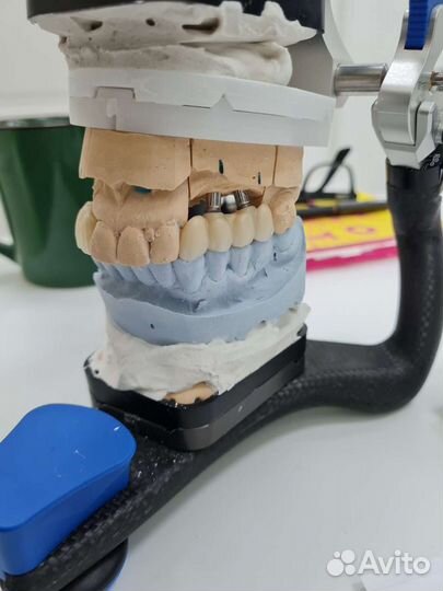 3d моделирование в exocad