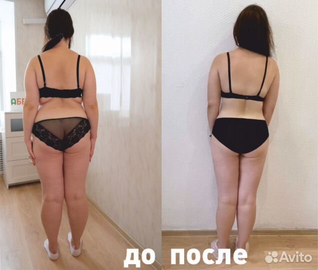 LPG массаж тела, лица (45 мин)