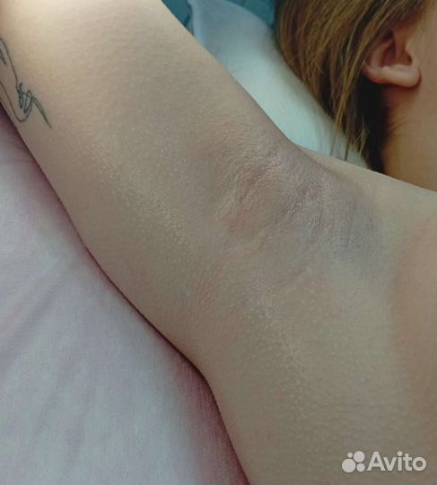 Шугаринг ваксинг