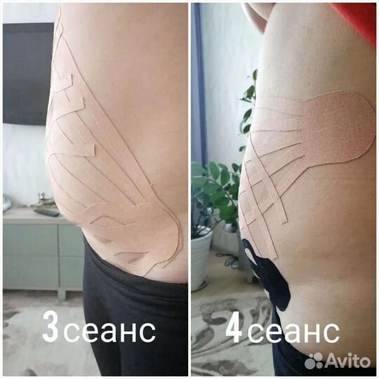 Типирования