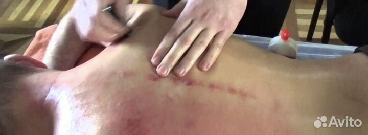 Массаж