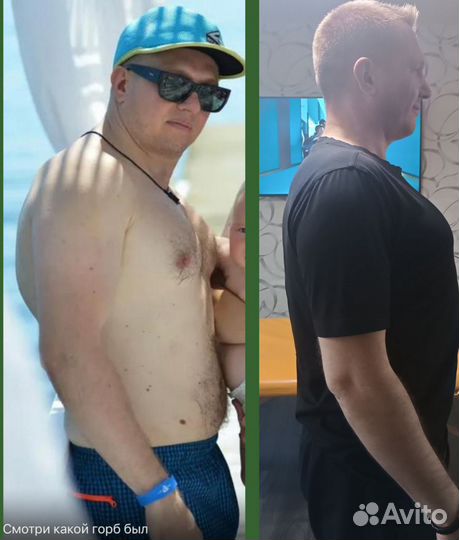 Мануальная процедура Высшей категории, массаж