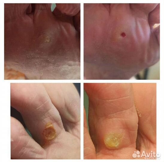 Педикюр Подолог Ленинский проспект