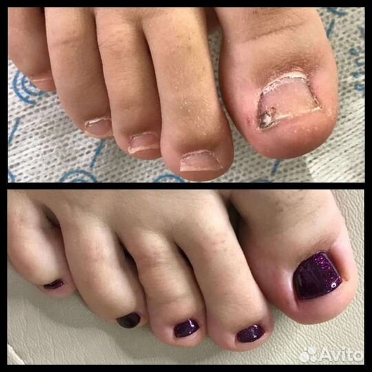 SMART - педикюр