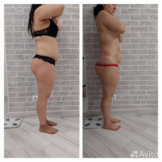 Массаж коррекционный, моментальный загар