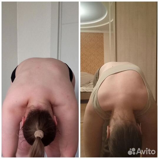 Акупрессура