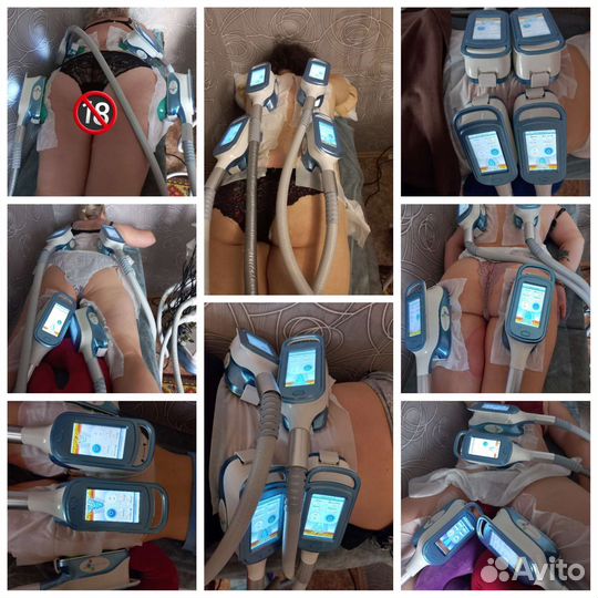 Криолиполиз Похудение без диет