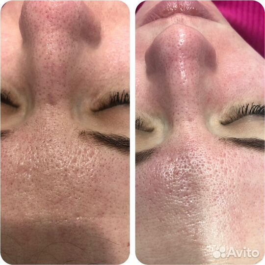 Косметолог эстетист