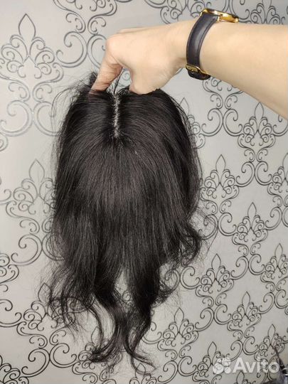 Теменная накладка