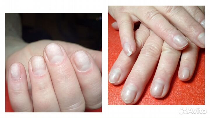 Маникюр, педикюр на дому