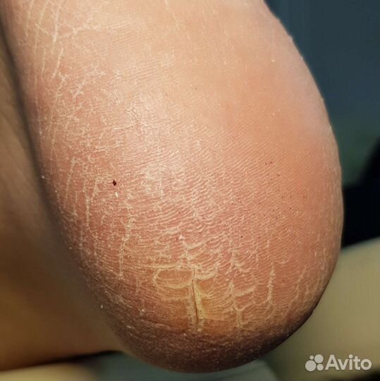 Smart педикюр