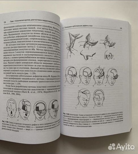 Практическая оториноларингология. Хирургия носа