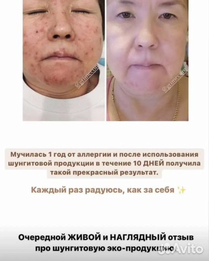 Шунгитовое мыло