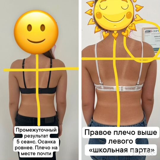 Манульный массаж, костоправ, без боли