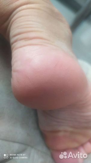 Педикюр, маникюр на дому