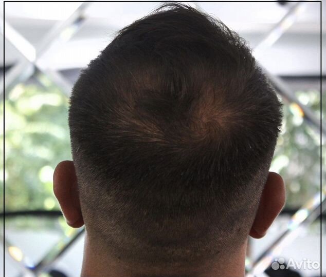 Продается доля прибыльного бизнеса в Турции