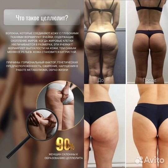 Массаж LPG коррекция фигуры