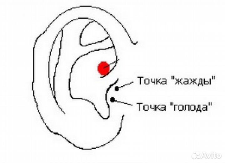 Точка голода (ботулотоксин типа А)