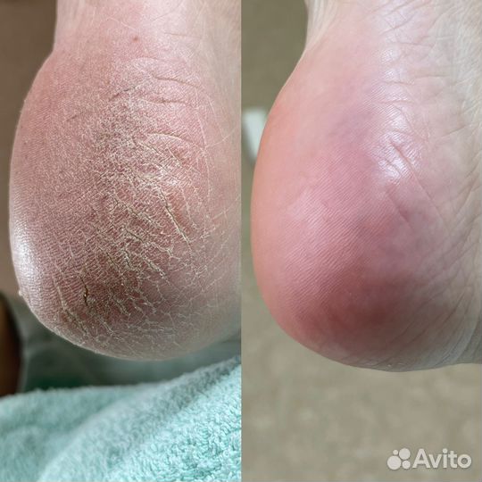 Педикюр Премиум