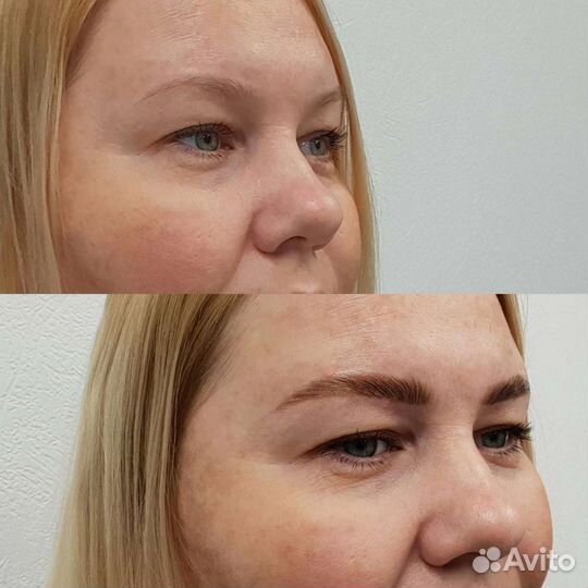 Консультация косметолога