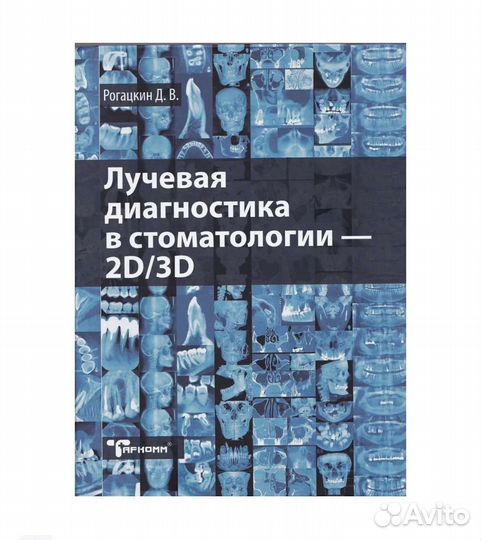 Лучевая диагностика в стоматологии 2D/3D