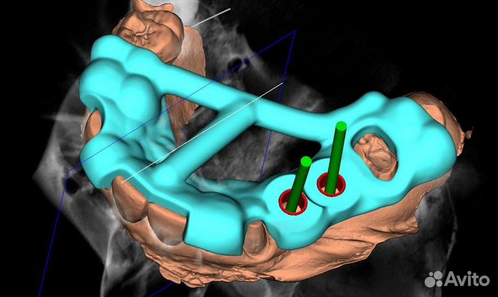 PlastyCad v1.7& 3Diagnosys v4.2 + Обучение