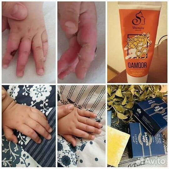 Бальзам камкор