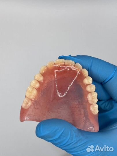 Зубной протез
