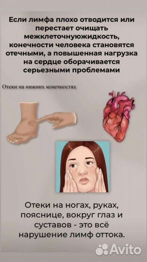 Снимает отеки