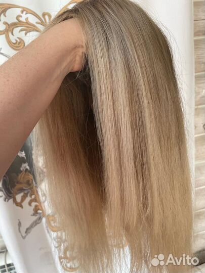 Система замещения волос