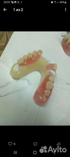 Зубной техник съемное протезирование