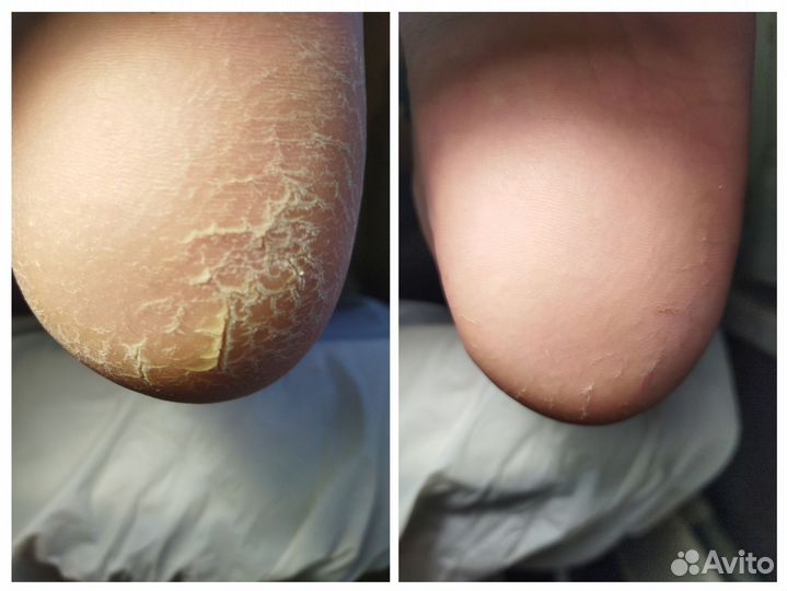 Педикюр, маникюр, гель-лак