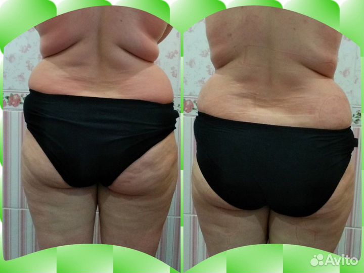 Коррекция фигуры