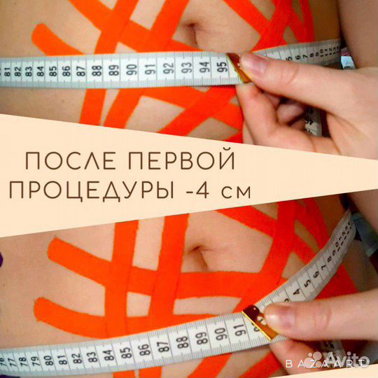 Лимфодренажное тейпирование