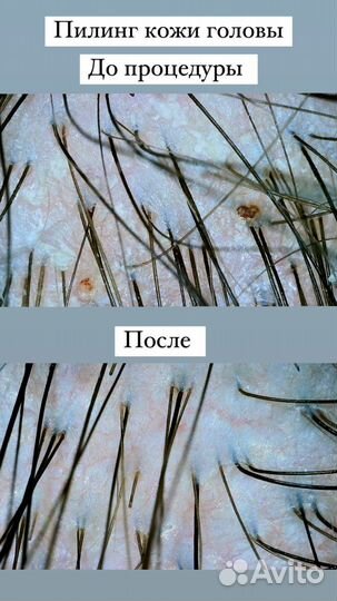 Восстановление и лечение волос, пилинг, полировка