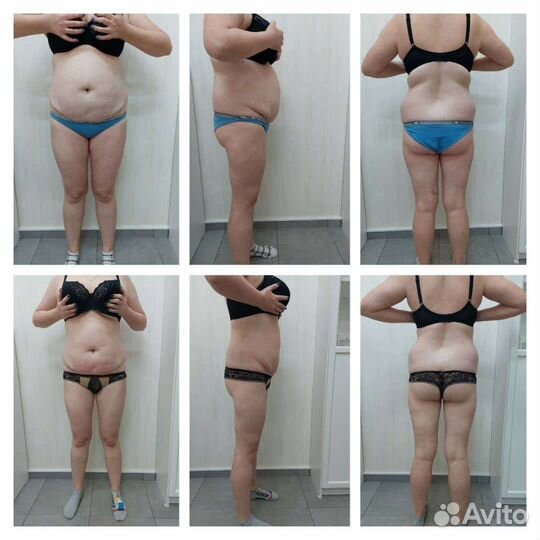 Массаж коррекционный, моментальный загар