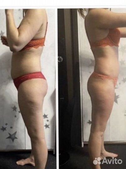 Массаж антицеллюлитный/коррекция/мёдовый