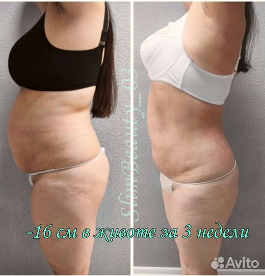 Аппаратная коррекция фигуры