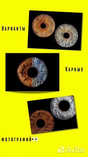 Уникальные снимки радужки за 30 минут