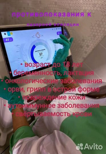 Лазерная эпиляция