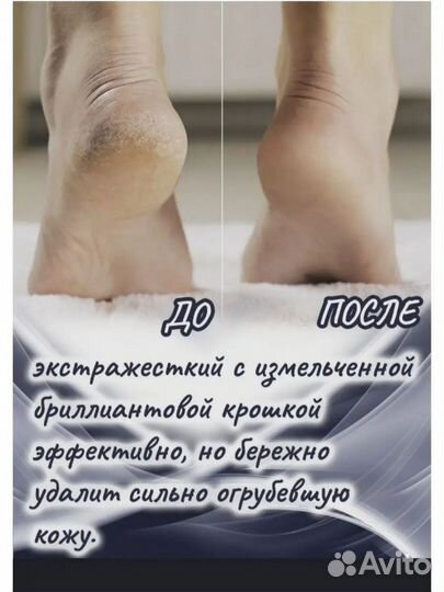 Сменные ролики к электрической пилке для ног