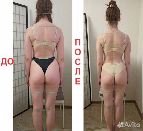 Здоровая спина / Анти сколиоз / Не массаж