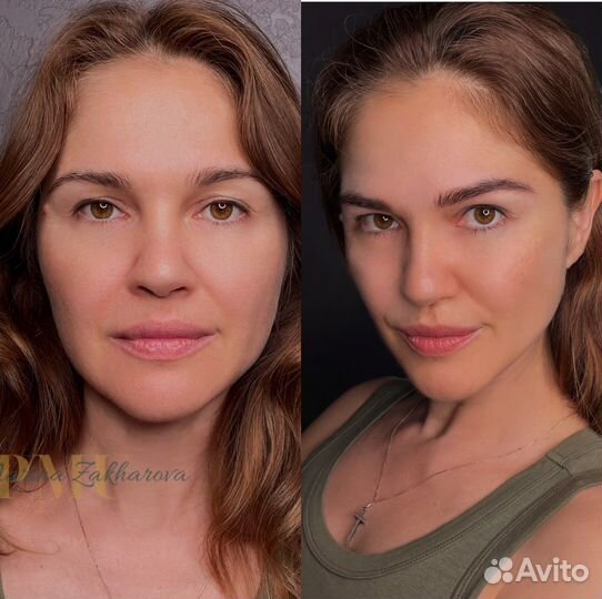 Волосковая техника, удаление пм,татуаж,перекрытие