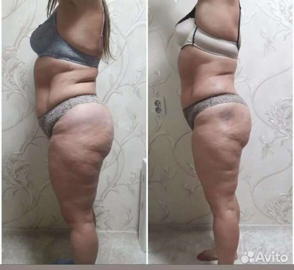 Набираю моделей на курс похудения