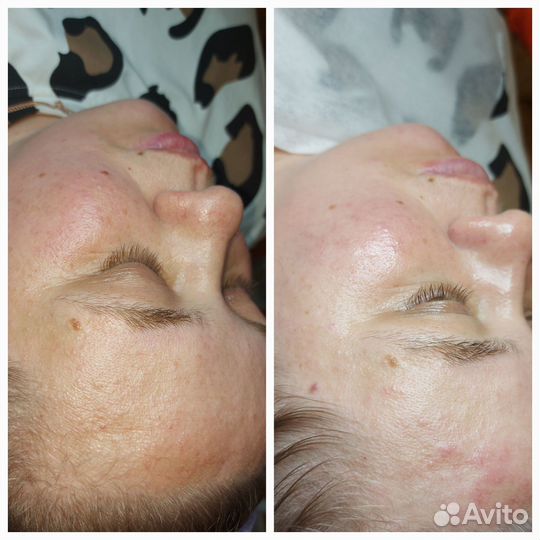 Косметолог эстетист услуги