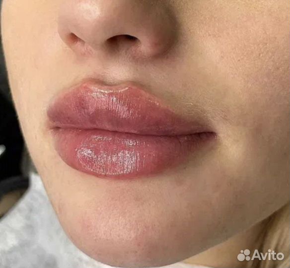 Обучение косметологов