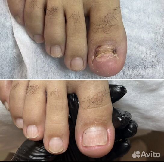 Подолог. Здоровье стоп и ногтей