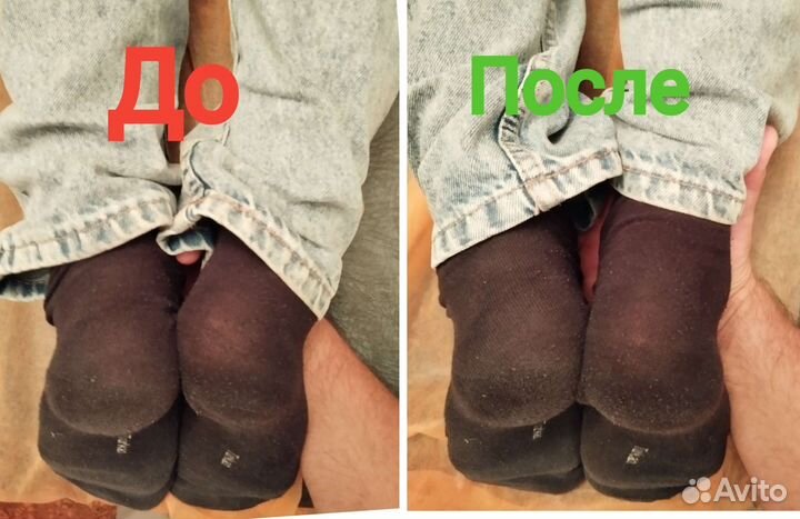 Костоправ, точечный массаж